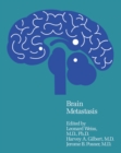 Brain Metastasis - eBook