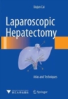 Laparoscopic Hepatectomy : Atlas and Techniques - Book