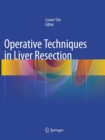 Operative Techniques in Liver Resection - Book