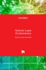 Systemic Lupus Erythematosus - Book