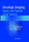 Oncologic Imaging: Spine and Spinal Cord Tumors - Book