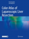 Color Atlas of Laparoscopic Liver Resection - Book