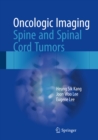 Oncologic Imaging: Spine and Spinal Cord Tumors - eBook
