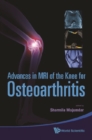 Advances In Mri Of The Knee For Osteoarthritis - eBook