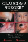 Glaucoma Surgery (2nd Edition) - eBook
