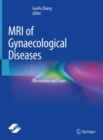 MRI of Gynaecological Diseases : Illustrations and Cases - Book