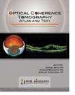 Optical Coherence Tomography : Atlas and Text - Book