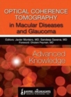Optical Coherence Tomography in Macular Diseases and Glaucoma: Advanced Knowledge - Book