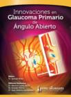 Innovaciones en Glaucoma Primario de Angulo Abierto - Book