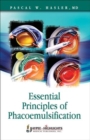 Essential Principles of Phacoemulsification - Book