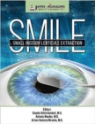 SMILE : Small Incision Lenticule Extraction - Book
