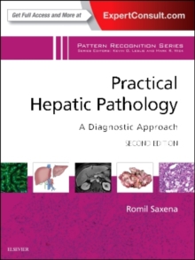 Practical Hepatic Pathology: A Diagnostic Approach : A Volume in the Pattern Recognition Series