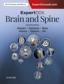 ExpertDDx: Brain and Spine : ExpertDDx: Brain and Spine E-Book