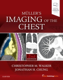 Muller's Imaging of the Chest : Expert Radiology Series