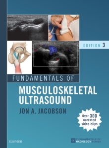 Fundamentals of Musculoskeletal Ultrasound E-Book : Fundamentals of Musculoskeletal Ultrasound E-Book