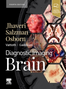 Diagnostic Imaging: Brain : Diagnostic Imaging: Brain E-Book