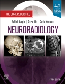 Neuroradiology : The Core Requisites