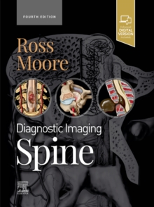 Diagnostic Imaging: Spine - E-Book : Diagnostic Imaging: Spine - E-Book