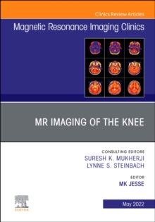 MR Imaging of The Knee, An Issue of Magnetic Resonance Imaging Clinics of North America : Volume 30-2
