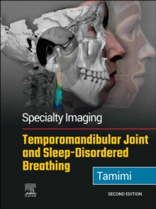 Specialty Imaging: Temporomandibular Joint and Sleep-Disordered Breathing : Specialty Imaging: Temporomandibular Joint and Sleep-Disordered Breathing E-Book