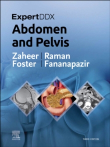ExpertDDx: Abdomen and Pelvis E-Book : ExpertDDx: Abdomen and Pelvis E-Book