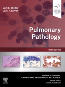 Pulmonary Pathology : Pulmonary Pathology E-Book