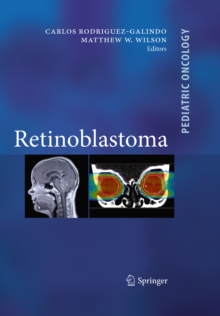 Retinoblastoma