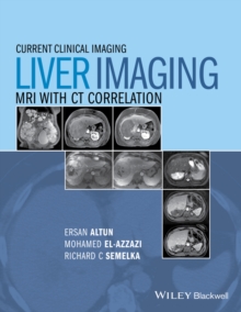 Liver Imaging : MRI with CT Correlation