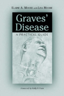 Graves' Disease : A Practical Guide