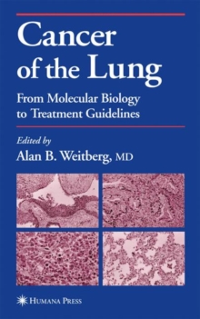 Cancer of the Lung : From Molecular Biology to Treatment Guidelines