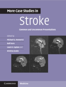 More Case Studies in Stroke : Common and Uncommon Presentations