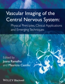 Vascular Imaging of the Central Nervous System : Physical Principles, Clinical Applications, and Emerging Techniques