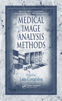 Medical Image Analysis Methods