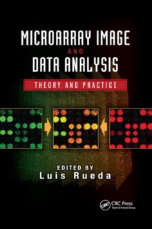 Microarray Image and Data Analysis : Theory and Practice