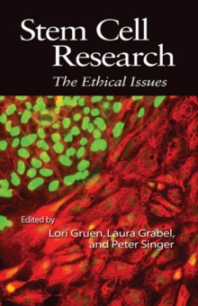 Stem Cell Research : The Ethical Issues