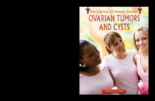 Ovarian Tumors and Cysts