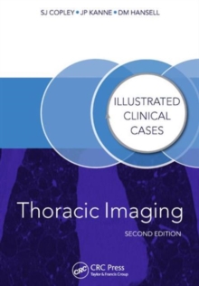Thoracic Imaging : Illustrated Clinical Cases, Second Edition