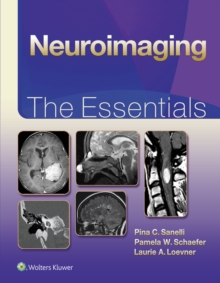 Neuroimaging: The Essentials