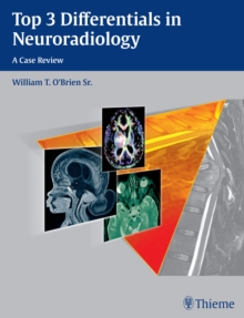 Top 3 Differentials in Neuroradiology : A Case Review
