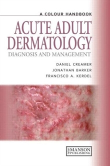 Acute Adult Dermatology : Diagnosis and Management: A Colour Handbook