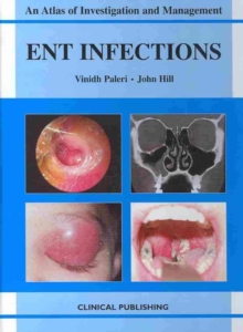 ENT Infections