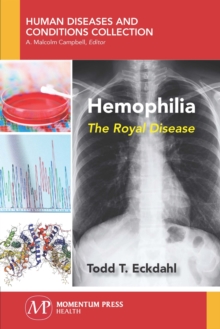 Hemophilia : The Royal Disease