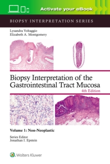 Biopsy Interpretation of the Gastrointestinal Tract Mucosa Volume 1 : Non-Neoplastic: Print + eBook with Multimedia