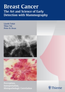 Breast Cancer - The Art and Science of Early Detection with Mammography : Perception, Interpretation, Histopathologic Correlation