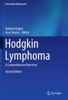 Hodgkin Lymphoma : A Comprehensive Overview
