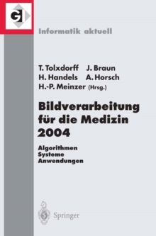Bildverarbeitung fur die Medizin 2004 : Algorithmen - Systeme - Anwendungen