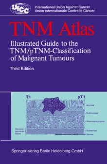 TNM Atlas : Illustrated Guide to the TNM/pTNM-Classification of Malignant Tumours