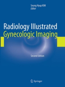 Radiology Illustrated: Gynecologic Imaging