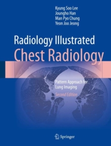 Radiology Illustrated: Chest Radiology : Pattern Approach for Lung Imaging