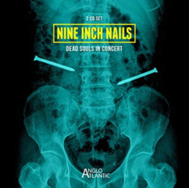 Nine Inch Nails: Dead Souls in Concert, CD / Album Cd